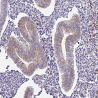 Anti-TMEM121 Antibody