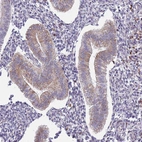 Anti-TMEM121 Antibody