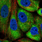 Immunofluorescent staining of human cell line MCF7 shows localization to cytosol.