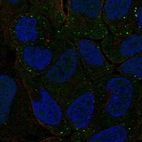 Immunofluorescent staining of human cell line RT4 shows localization to vesicles.