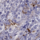 Anti-GPR50 Antibody