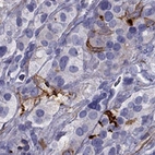 Anti-GPR50 Antibody