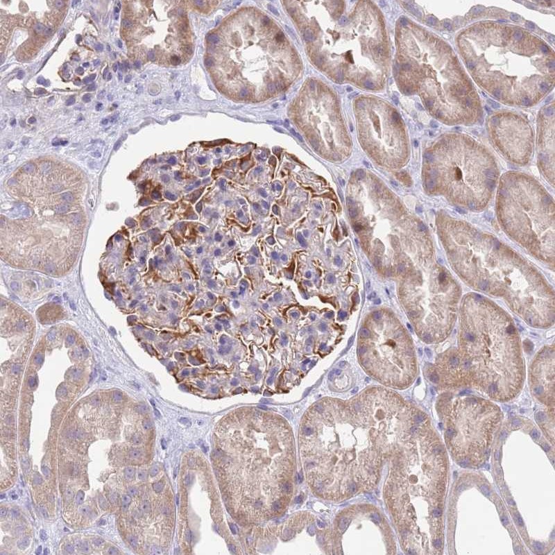 Anti-ZNF14 Antibody