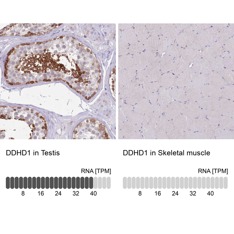 Anti-DDHD1 Antibody
