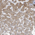 Immunohistochemical staining of human liver shows moderate membranous positivity in hepatocytes.