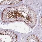 Immunohistochemical staining of human testis shows strong cytoplasmic positivity in cells in seminiferous ducts.