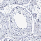Immunohistochemical staining of human testis shows no positivity in cells in seminiferous ducts as expected.