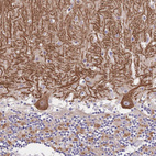 Immunohistochemical staining of human cerebellum shows moderate cytoplasmic positivity in Purkinje cells.