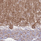 Immunohistochemical staining of human cerebellum shows moderate cytoplasmic positivity in Purkinje cells.