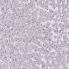 Immunohistochemical staining of human liver shows no positivity in hepatocytes as expected.