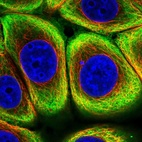 Immunofluorescent staining of human cell line MCF7 shows localization to intermediate filaments.