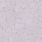 Immunohistochemical staining of human skeletal muscle shows no positivity in myocytes as expected.
