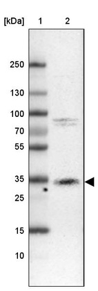 Lane 1: Marker [kDa] 250, 130, 100, 70, 55, 35, 25, 15, 10_br/_Lane 2: Human cell line CACO-2