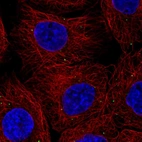 Immunofluorescent staining of human cell line A-431 shows localization to vesicles.