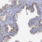 Anti-ZNF852 Antibody