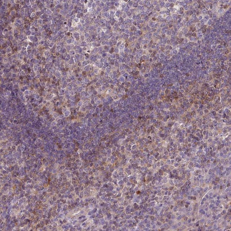 Anti-STAT5A Antibody