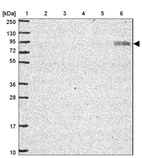 Lane 1: Marker [kDa] 250, 130, 95, 72, 55, 36, 28, 17, 10_br/_Lane 2: Human cell line RT-4_br/_Lane 3: Human cell line U-251 MG_br/_Lane 4: Human plasma_br/_Lane 5: Human Liver tissue_br/_Lane 6: Human Tonsil tissue