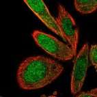 Immunofluorescent staining of human cell line PC-3 shows localization to nucleus & cytosol.