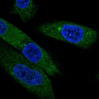 Immunofluorescent staining of human cell line PC-3 shows localization to endoplasmic reticulum.