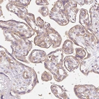Immunohistochemical staining of human placenta shows moderate membranous and cytoplasmic positivity in trophoblastic cells.