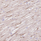 Immunohistochemical staining of human heart muscle shows moderate cytoplasmic positivity in cardiomyocytes.