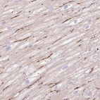 Immunohistochemical staining of human heart muscle shows moderate cytoplasmic positivity in cardiomyocytes.