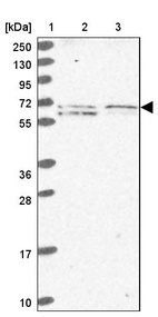 Lane 1: Marker [kDa] 250, 130, 95, 72, 55, 36, 28, 17, 10_br/_Lane 2: Human cell line RT-4_br/_Lane 3: Human cell line U-251MG sp