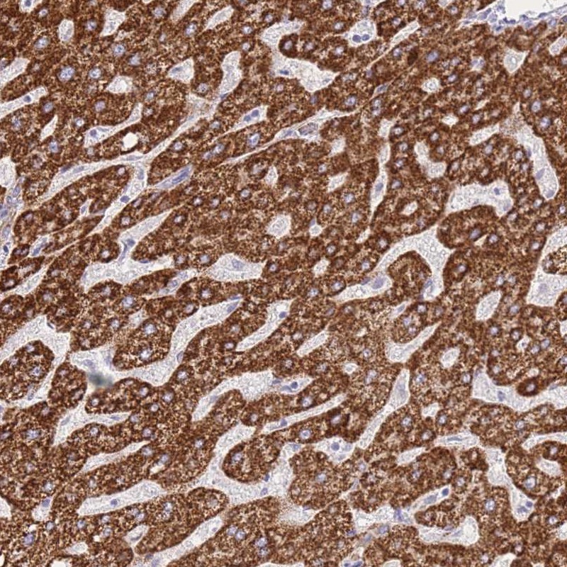 Anti-ACSM4 Antibody