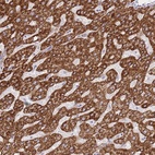 Anti-ACSM4 Antibody