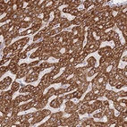 Anti-ACSM4 Antibody