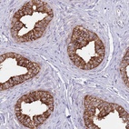 Immunohistochemical staining of human epididymis shows high expression.