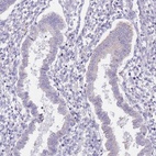 Immunohistochemical staining of human endometrium shows low expression as expected.