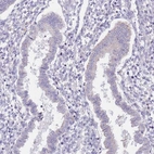 Immunohistochemical staining of human endometrium shows low expression as expected.
