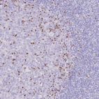 Immunohistochemical staining of human tonsil shows strong nuclear positivity in germinal center cells.