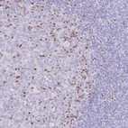 Immunohistochemical staining of human tonsil shows strong nuclear positivity in germinal center cells.