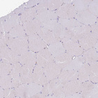 Immunohistochemical staining of human skeletal muscle shows no positivity in myocytes as expected.