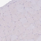 Immunohistochemical staining of human skeletal muscle shows no positivity in myocytes as expected.