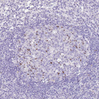 Immunohistochemical staining of human lymph node shows strong nuclear positivity in germinal center cells.