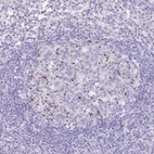 Immunohistochemical staining of human lymph node shows strong nuclear positivity in germinal center cells.