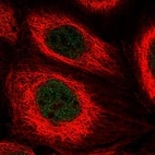 Immunofluorescent staining of human cell line A-431 shows localization to nucleoplasm.