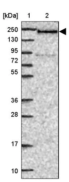 Lane 1: Marker [kDa] 250, 130, 95, 72, 55, 36, 28, 17, 10_br/_Lane 2: Human cell line RT-4