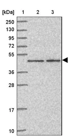 Lane 1: Marker [kDa] 250, 130, 95, 72, 55, 36, 28, 17, 10_br/_Lane 2: Human cell line RT-4_br/_Lane 3: Human cell line U-251MG sp