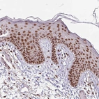 Immunohistochemical staining of human skin shows moderate to strong nuclear positivity in squamous epithelial cells.