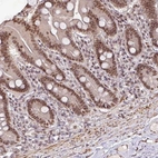 Immunohistochemical staining of human duodenum shows moderate nuclear positivity in glandular cells.