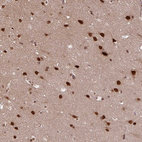 Immunohistochemical staining of human cerebral cortex shows strong nuclear positivity in neurons.