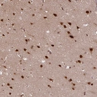 Immunohistochemical staining of human cerebral cortex shows strong nuclear positivity in neurons.