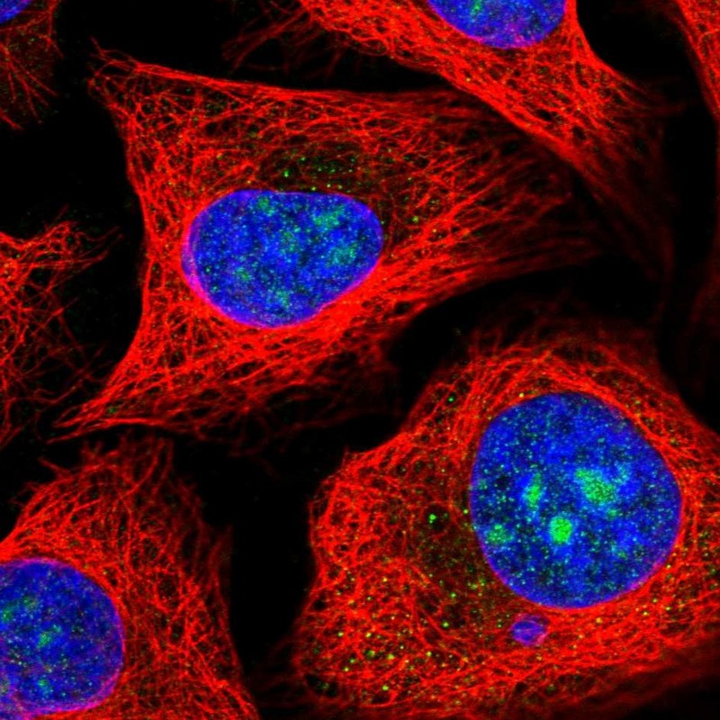 Anti-MPHOSPH10 Antibody