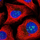 Anti-MPHOSPH10 Antibody