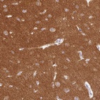 Anti-DNM1 Antibody