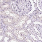 Anti-DNM1 Antibody